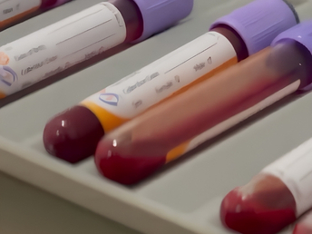 hematologia